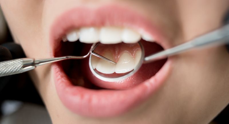 Tandlægevalg – en tillidssag